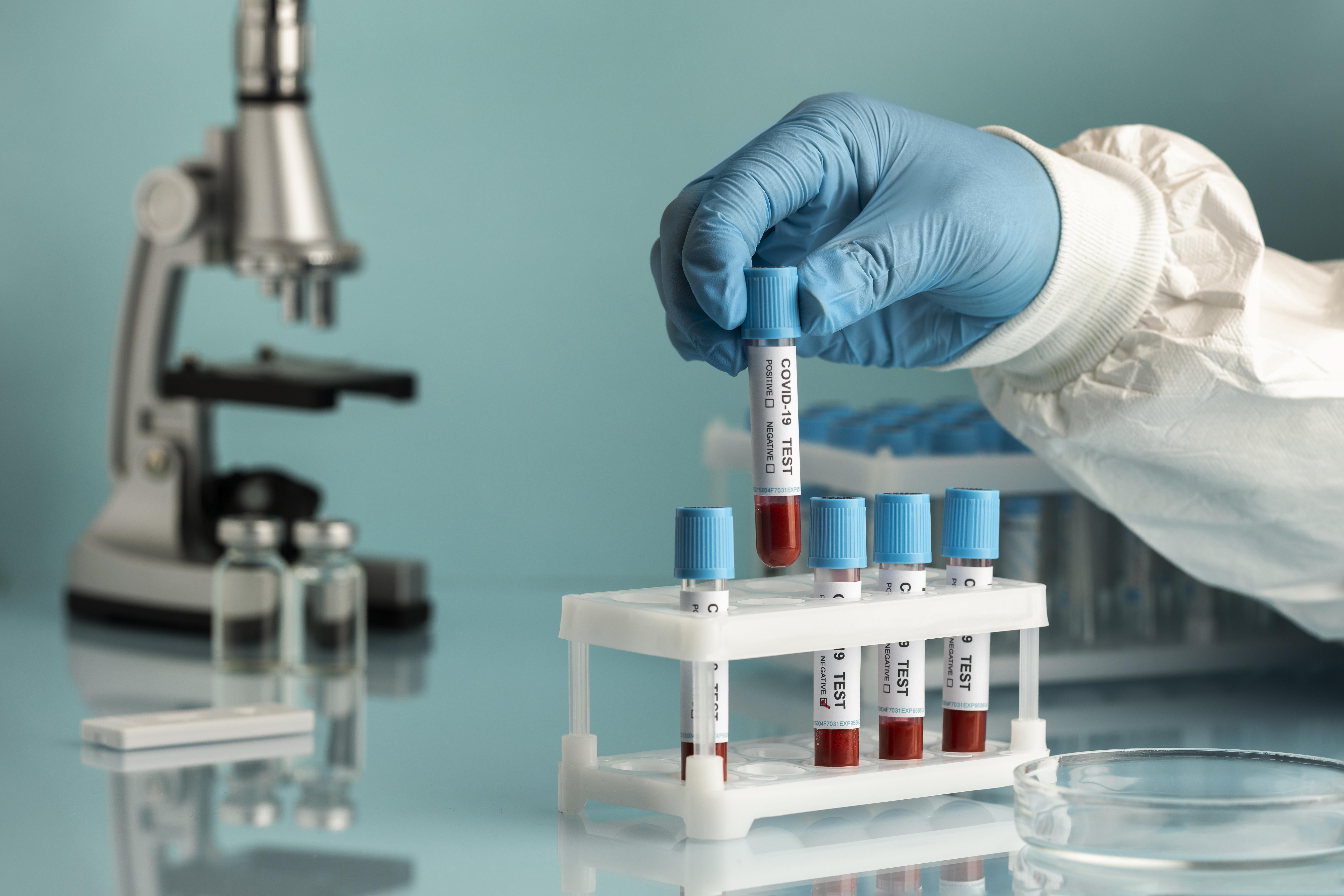 ANTICOAGULANTE  LUPICO