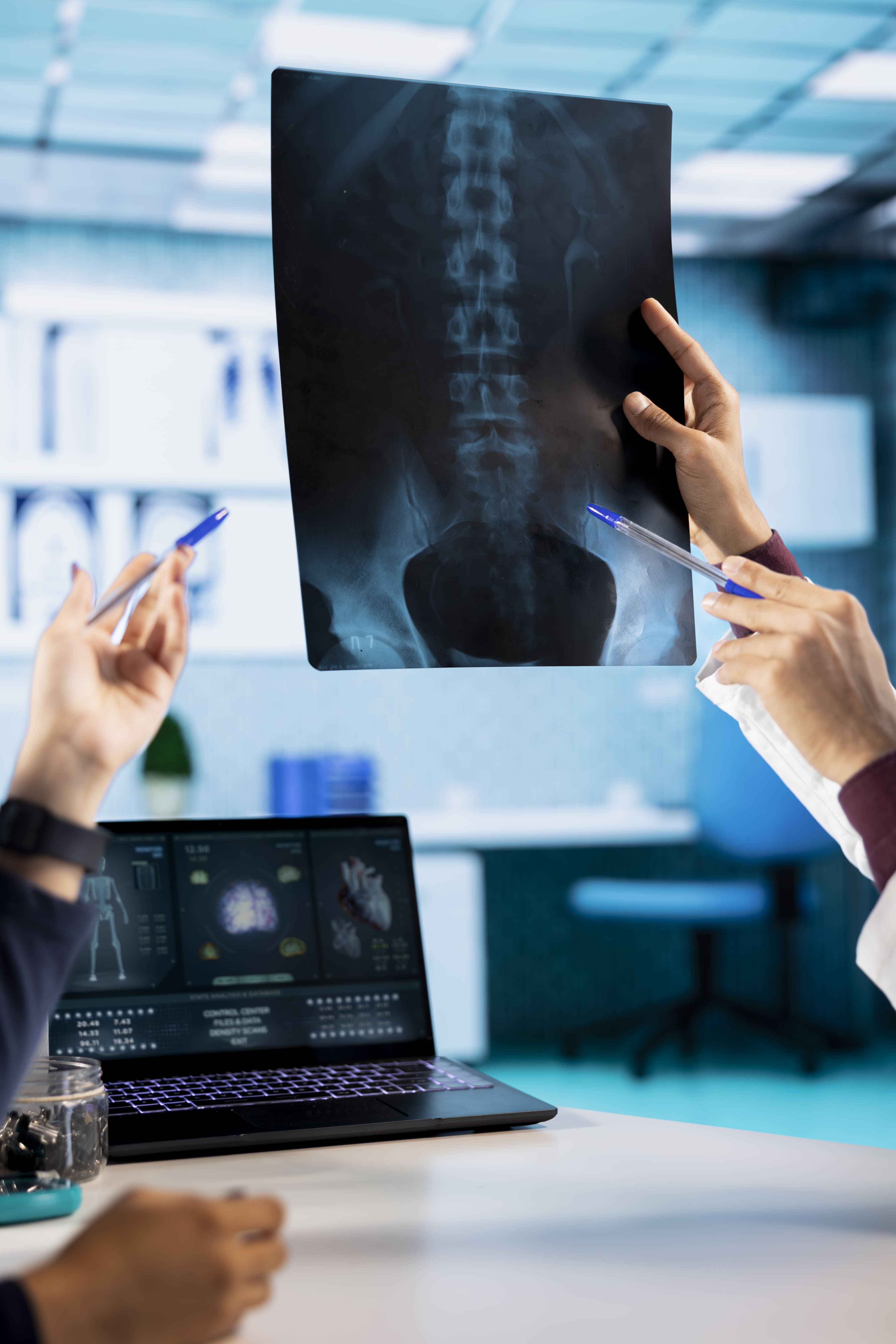 COLUMNA LUMBAR DINAMICAS