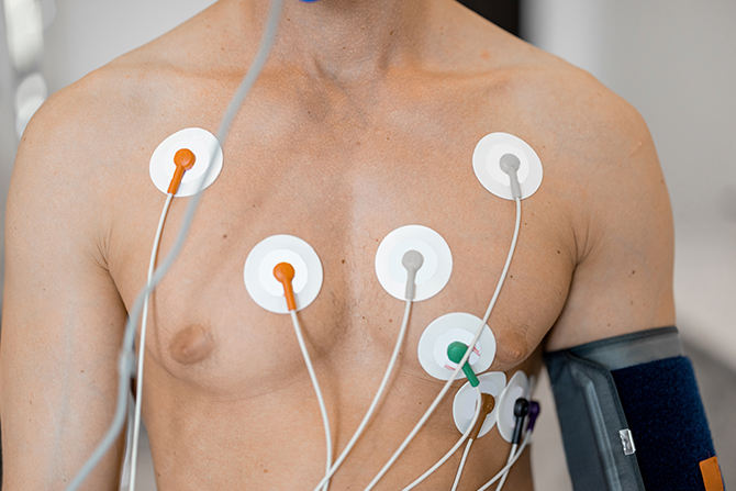 ELECTROCARDIOGRAMA