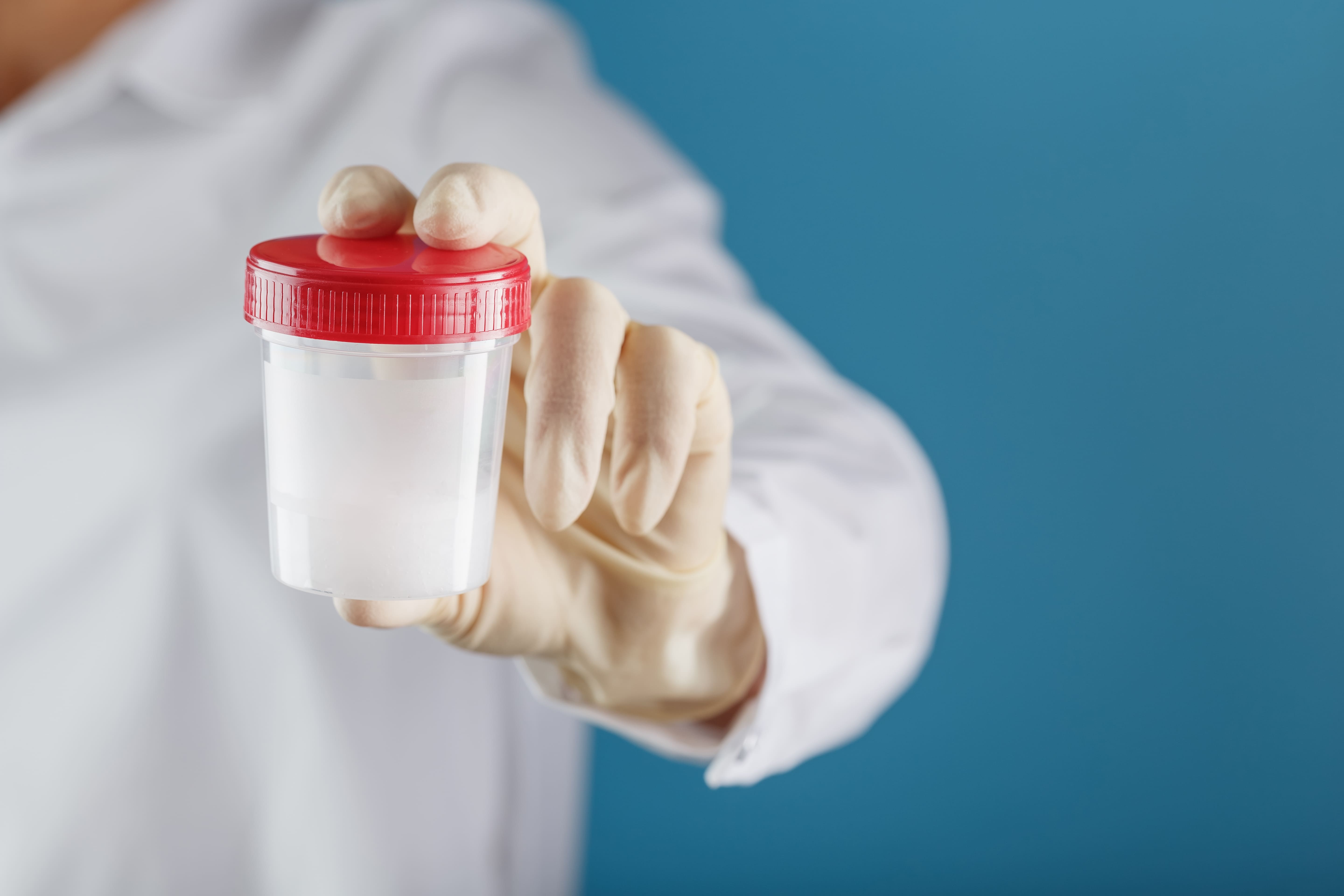 AMIBA EN FRESCO Y CITOLOGÍA DE MOCO FECAL